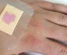 In arrivo il cerotto nanotecnologico che cambia colore se la ferita è infetta