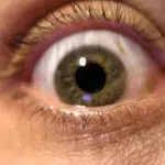 Glaucoma 2016, parte la campagna di prevenzione