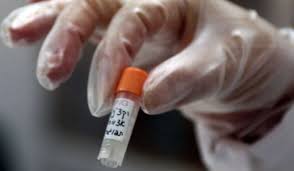 Quali rischi corrono i pazienti sopravvissuti all'Ebola?