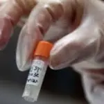 Quali rischi corrono i pazienti sopravvissuti all'Ebola?