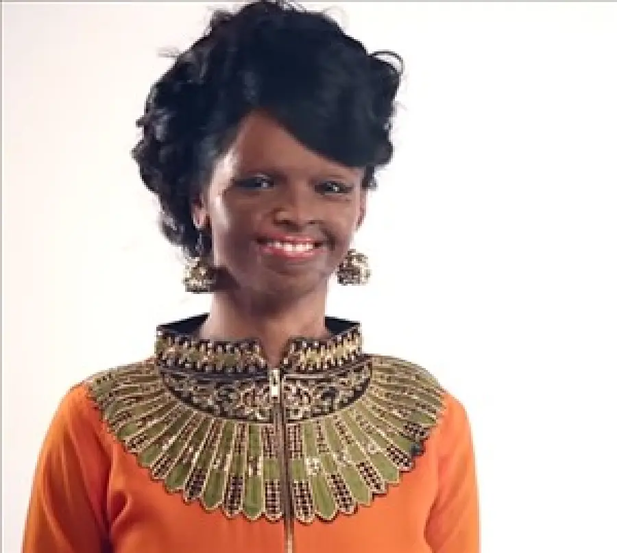 India: Laxmi Agarwal, sfregiata a 15 anni dall'acido, diventa testimonial di un marchio di moda