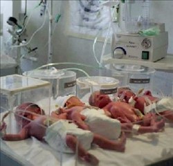 Festa al Gaslini di Genova: parto quadrigemellare perfettamente riuscito