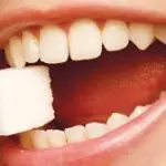 Cura Carie: intervenire con uno smalto speciale a base di fluoro per evitare le otturazioni