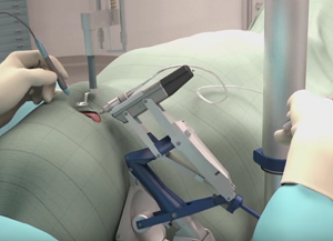 robot-chirurgia